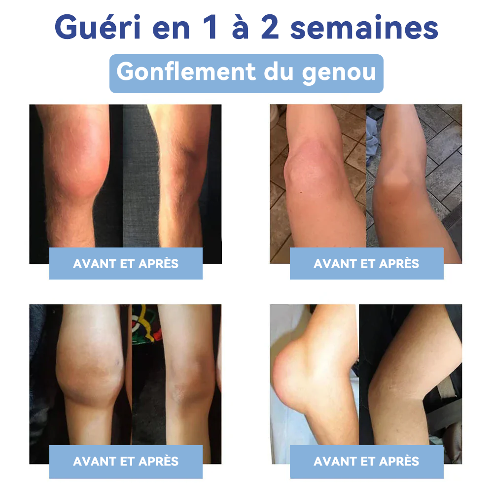 ✅Boutique officielle : 𝐒𝐏𝐙𝐕® 𝐌𝐚𝐠𝐧é𝐬𝐢𝐮𝐦 𝐝𝐨𝐮𝐥𝐞𝐮𝐫 𝐫𝐞𝐥𝐢𝐞𝐟 𝐠𝐮é𝐫𝐢𝐬𝐨𝐧 𝐜𝐫è𝐦𝐞(Traitement de l'arthrite, de la neuropathie, des maladies rhumatismales, des spasmes musculaires, des contractions et des blessures sportives)🍁💖