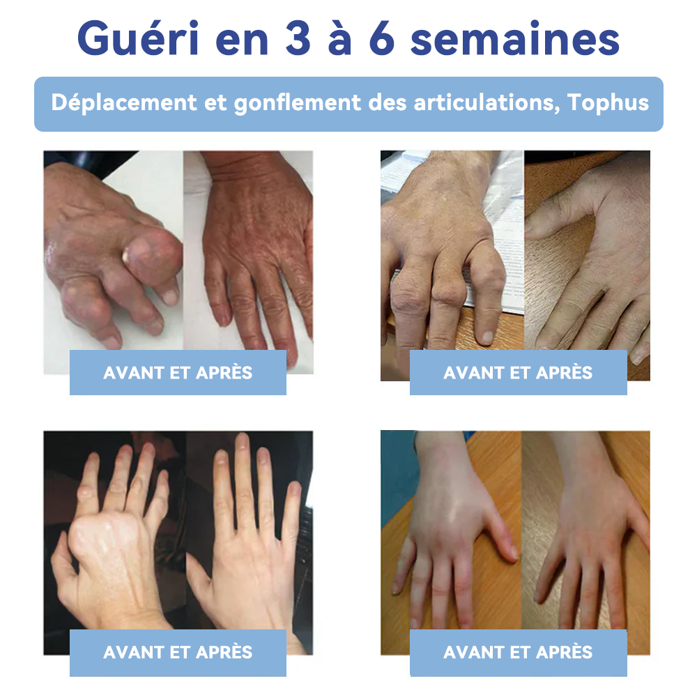 ✅Boutique officielle : 𝐒𝐏𝐙𝐕® 𝐌𝐚𝐠𝐧é𝐬𝐢𝐮𝐦 𝐝𝐨𝐮𝐥𝐞𝐮𝐫 𝐫𝐞𝐥𝐢𝐞𝐟 𝐠𝐮é𝐫𝐢𝐬𝐨𝐧 𝐜𝐫è𝐦𝐞(Traitement de l'arthrite, de la neuropathie, des maladies rhumatismales, des spasmes musculaires, des contractions et des blessures sportives)🍁💖