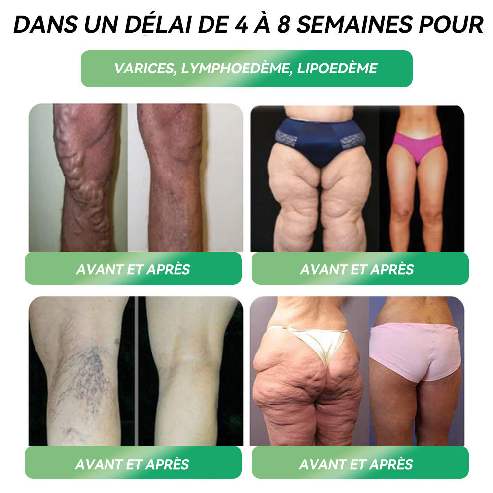 đ
Ă©đđąđđĄđđđ đđ 30 % đđđąđ đąđđ đđąđĂ©đ đđđđđĄĂ©đ â° đđđ·đžđŒÂźđșđżđ-1 đđđđđ đđđđĄđ đđđđ đđđđąđĄđđđ