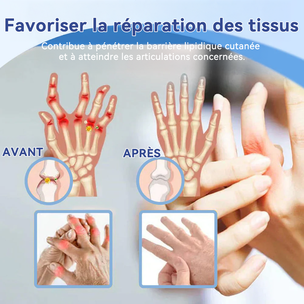 ✅Boutique officielle : 𝐒𝐏𝐙𝐕® 𝐌𝐚𝐠𝐧é𝐬𝐢𝐮𝐦 𝐝𝐨𝐮𝐥𝐞𝐮𝐫 𝐫𝐞𝐥𝐢𝐞𝐟 𝐠𝐮é𝐫𝐢𝐬𝐨𝐧 𝐜𝐫è𝐦𝐞(Traitement de l'arthrite, de la neuropathie, des maladies rhumatismales, des spasmes musculaires, des contractions et des blessures sportives)🍁💖
