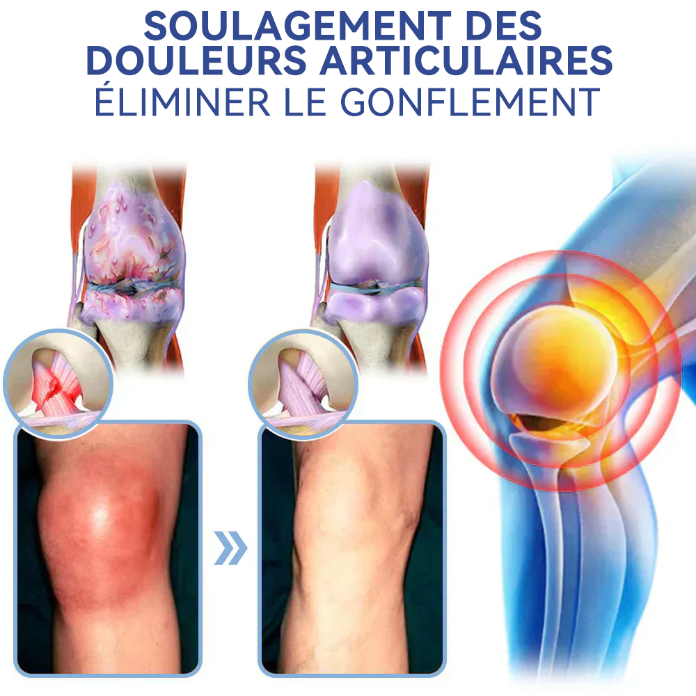 ✅Boutique officielle : 𝐒𝐏𝐙𝐕® 𝐌𝐚𝐠𝐧é𝐬𝐢𝐮𝐦 𝐝𝐨𝐮𝐥𝐞𝐮𝐫 𝐫𝐞𝐥𝐢𝐞𝐟 𝐠𝐮é𝐫𝐢𝐬𝐨𝐧 𝐜𝐫è𝐦𝐞(Traitement de l'arthrite, de la neuropathie, des maladies rhumatismales, des spasmes musculaires, des contractions et des blessures sportives)🍁💖