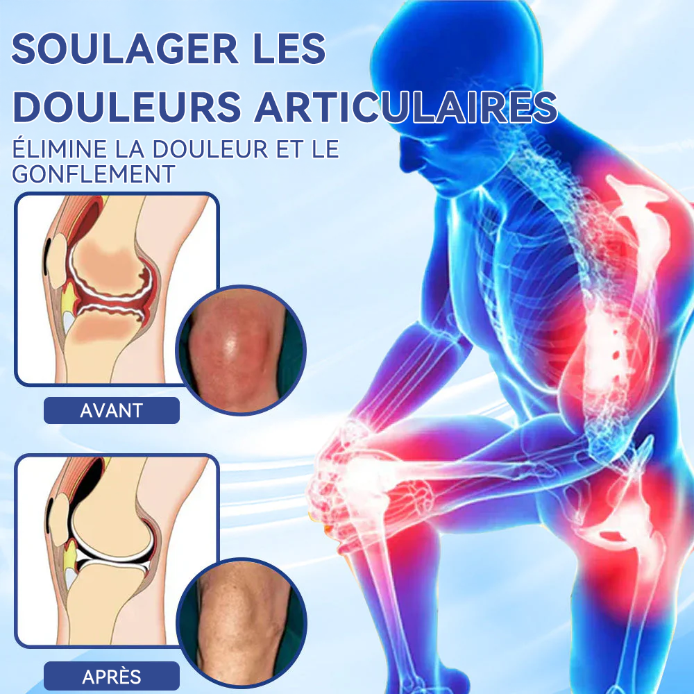 ✅Boutique officielle : 𝐒𝐏𝐙𝐕® 𝐌𝐚𝐠𝐧é𝐬𝐢𝐮𝐦 𝐝𝐨𝐮𝐥𝐞𝐮𝐫 𝐫𝐞𝐥𝐢𝐞𝐟 𝐠𝐮é𝐫𝐢𝐬𝐨𝐧 𝐜𝐫è𝐦𝐞(Traitement de l'arthrite, de la neuropathie, des maladies rhumatismales, des spasmes musculaires, des contractions et des blessures sportives)🍁💖