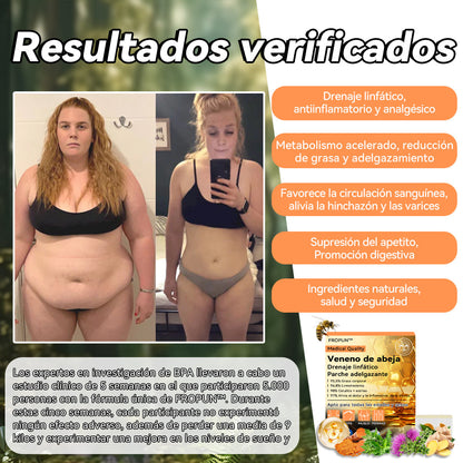 🛴🛴𝐅𝐑𝐎𝐏𝐔𝐍™ 𝐕𝐞𝐧𝐞𝐧𝐨 𝐝𝐞 𝐚𝐛𝐞𝐣𝐚 𝐃𝐫𝐞𝐧𝐚𝐣𝐞 𝐥𝐢𝐧𝐟á𝐭𝐢𝐜𝐨𝐏𝐚𝐫𝐜𝐡𝐞 𝐚𝐝𝐞𝐥𝐠𝐚𝐳𝐚𝐧𝐭𝐞 (𝐏𝐚𝐫𝐚 𝐭𝐨𝐝𝐨𝐬 𝐥𝐨𝐬 𝐩𝐫𝐨𝐛𝐥𝐞𝐦𝐚𝐬 𝐥𝐢𝐧𝐟á𝐭𝐢𝐜𝐨𝐬 𝐲 𝐥𝐚 𝐨𝐛𝐞𝐬𝐢𝐝𝐚𝐝)