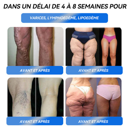 𝐈𝐅𝐌𝐀𝐆𝐈𝐂® 𝐆𝐋𝐏-𝟏 𝐏𝐫𝐨 𝐖𝐞𝐢𝐠𝐡𝐭 𝐋𝐨𝐬𝐬 𝐎𝐫𝐚𝐥 𝐒𝐨𝐥𝐮𝐭𝐢𝐨𝐧 🍁💖