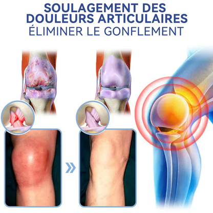 ✅Boutique officielle : 𝐒𝐏𝐙𝐕® 𝐌𝐚𝐠𝐧é𝐬𝐢𝐮𝐦 𝐝𝐨𝐮𝐥𝐞𝐮𝐫 𝐫𝐞𝐥𝐢𝐞𝐟 𝐠𝐮é𝐫𝐢𝐬𝐨𝐧 𝐜𝐫è𝐦𝐞(Traitement de l'arthrite, de la neuropathie, des maladies rhumatismales, des spasmes musculaires, des contractions et des blessures sportives)🍁💖