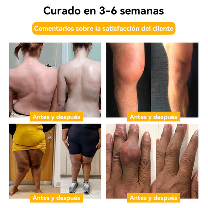🏆💥𝐒𝐩𝐳𝐯™ 𝐕𝐞𝐧𝐞𝐧𝐨 𝐝𝐞 𝐚𝐛𝐞𝐣𝐚 𝐂𝐫𝐞𝐦𝐚 𝐓𝐫𝐚𝐭𝐚𝐦𝐢𝐞𝐧𝐭𝐨 𝐀𝐫𝐭𝐢𝐜𝐮𝐥𝐚𝐜𝐢𝐨𝐧𝐞𝐬 𝐲 𝐇𝐮𝐞𝐬𝐨𝐬🐝(𝐄𝐱𝐭𝐫𝐚𝐜𝐭𝐨 𝐝𝐞 𝐚𝐛𝐞𝐣𝐚 𝐝𝐞 𝐍𝐮𝐞𝐯𝐚 𝐙𝐞𝐥𝐚𝐧𝐝𝐚𝐄𝐬𝐩𝐞𝐜𝐢𝐚𝐥𝐢𝐳𝐚𝐝𝐨 𝐞𝐧 𝐞𝐧𝐟𝐞𝐫𝐦𝐞𝐝𝐚𝐝𝐞𝐬 𝐨𝐫𝐭𝐨𝐩é𝐝𝐢𝐜𝐚𝐬 𝐲 𝐝𝐨𝐥𝐨𝐫𝐞𝐬 𝐚𝐫𝐭𝐫í𝐭𝐢𝐜𝐨𝐬)