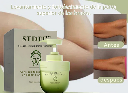 STDEI™  𝐶𝑜𝑙á𝑔𝑒𝑛𝑜 𝑑𝑒 𝑙𝑢𝑗𝑜 𝑐𝑟𝑒𝑚𝑎 𝑟𝑒𝑎𝑓𝑖𝑟𝑚𝑎𝑛𝑡𝑒 🎄