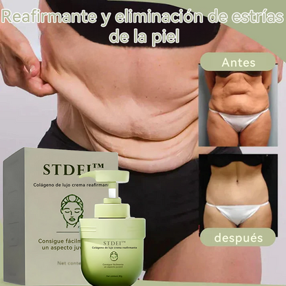 STDEI™  𝐶𝑜𝑙á𝑔𝑒𝑛𝑜 𝑑𝑒 𝑙𝑢𝑗𝑜 𝑐𝑟𝑒𝑚𝑎 𝑟𝑒𝑎𝑓𝑖𝑟𝑚𝑎𝑛𝑡𝑒 🎄