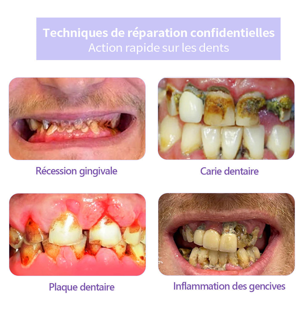 𝐎𝐲𝐢𝐤𝐞𝐲® 𝐑𝐞𝐬𝐭𝐚𝐮𝐫𝐚𝐭𝐢𝐨𝐧 𝐃𝐞𝐬 𝐃𝐞𝐧𝐭𝐬 𝐏𝐨𝐮𝐝𝐫𝐞 𝐌𝐢𝐧é𝐫𝐚𝐥𝐞🍁💖