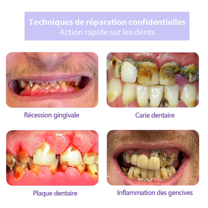 𝐎𝐲𝐢𝐤𝐞𝐲® 𝐑𝐞𝐬𝐭𝐚𝐮𝐫𝐚𝐭𝐢𝐨𝐧 𝐃𝐞𝐬 𝐃𝐞𝐧𝐭𝐬 𝐏𝐨𝐮𝐝𝐫𝐞 𝐌𝐢𝐧é𝐫𝐚𝐥𝐞🍁💖