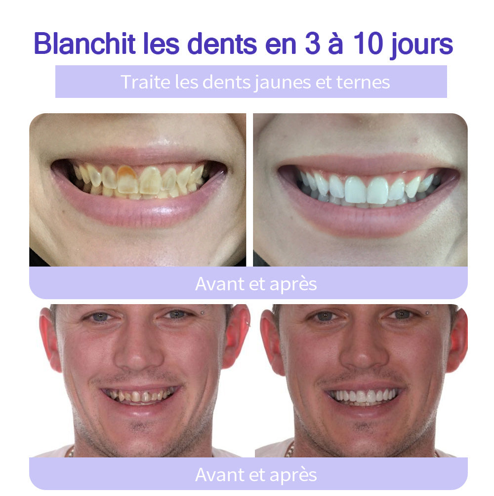 𝐎𝐲𝐢𝐤𝐞𝐲® 𝐑𝐞𝐬𝐭𝐚𝐮𝐫𝐚𝐭𝐢𝐨𝐧 𝐃𝐞𝐬 𝐃𝐞𝐧𝐭𝐬 𝐏𝐨𝐮𝐝𝐫𝐞 𝐌𝐢𝐧é𝐫𝐚𝐥𝐞🍁💖