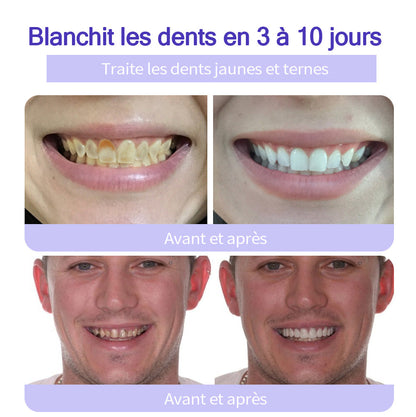 𝐎𝐲𝐢𝐤𝐞𝐲® 𝐑𝐞𝐬𝐭𝐚𝐮𝐫𝐚𝐭𝐢𝐨𝐧 𝐃𝐞𝐬 𝐃𝐞𝐧𝐭𝐬 𝐏𝐨𝐮𝐝𝐫𝐞 𝐌𝐢𝐧é𝐫𝐚𝐥𝐞🍁💖