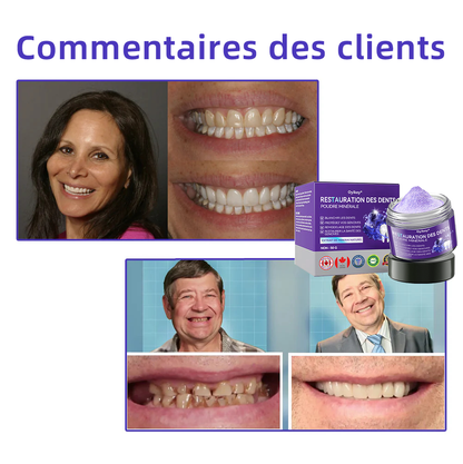𝐎𝐲𝐢𝐤𝐞𝐲® 𝐑𝐞𝐬𝐭𝐚𝐮𝐫𝐚𝐭𝐢𝐨𝐧 𝐃𝐞𝐬 𝐃𝐞𝐧𝐭𝐬 𝐏𝐨𝐮𝐝𝐫𝐞 𝐌𝐢𝐧é𝐫𝐚𝐥𝐞🍁💖