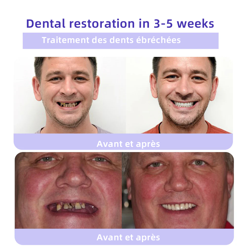 𝐎𝐲𝐢𝐤𝐞𝐲® 𝐑𝐞𝐬𝐭𝐚𝐮𝐫𝐚𝐭𝐢𝐨𝐧 𝐃𝐞𝐬 𝐃𝐞𝐧𝐭𝐬 𝐏𝐨𝐮𝐝𝐫𝐞 𝐌𝐢𝐧é𝐫𝐚𝐥𝐞🍁💖