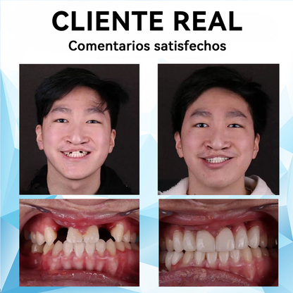 🐼🐼𝐁𝐢𝐤𝐞𝐧𝐝𝐚™💡 𝐉𝐮𝐞𝐠𝐨 𝐝𝐞 𝐝𝐞𝐧𝐭𝐚𝐝𝐮𝐫𝐚 𝐩𝐨𝐬𝐭𝐢𝐳𝐚 𝐜𝐨𝐧 𝐚𝐥𝐦𝐨𝐡𝐚𝐝𝐢𝐥𝐥𝐚 𝐝𝐞 𝐬𝐢𝐥𝐢𝐜𝐨𝐧𝐚 (⏰𝐃𝐞𝐬𝐜𝐮𝐞𝐧𝐭𝐨 𝐩𝐨𝐫 𝐭𝐢𝐞𝐦𝐩𝐨 𝐥𝐢𝐦𝐢𝐭𝐚𝐝𝐨 Ú𝐥𝐭𝐢𝐦𝐨𝐬 𝟑𝟎 𝐦𝐢𝐧𝐮𝐭𝐨𝐬⏰)